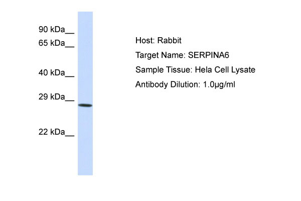 1 - SERPINA6 Antibody - middle region AI13340