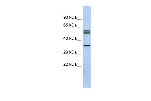 1 - DBT Antibody - N-terminal region AI13352