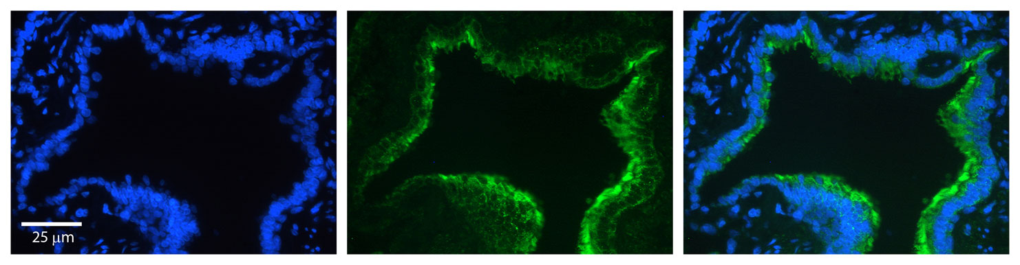 2 - CTTN antibody - N-terminal region AI13360