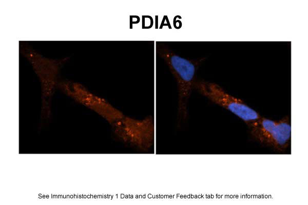 2 - PDIA6 antibody - N-terminal region AI13370