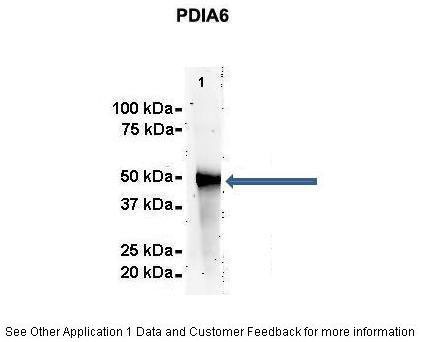 5 - PDIA6 antibody - N-terminal region AI13370