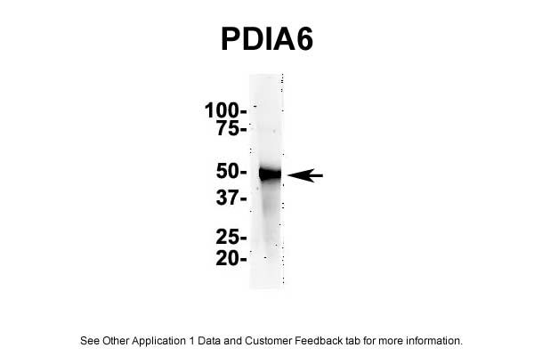 1 - PDIA6 antibody - N-terminal region AI13370