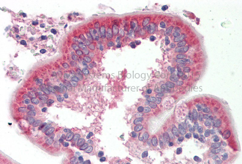 2 - NET1 antibody - middle region AI13373