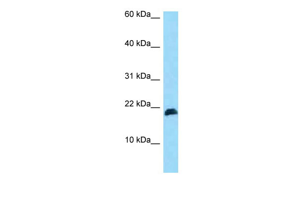 1 - HBXIP antibody - N-terminal region AI13381
