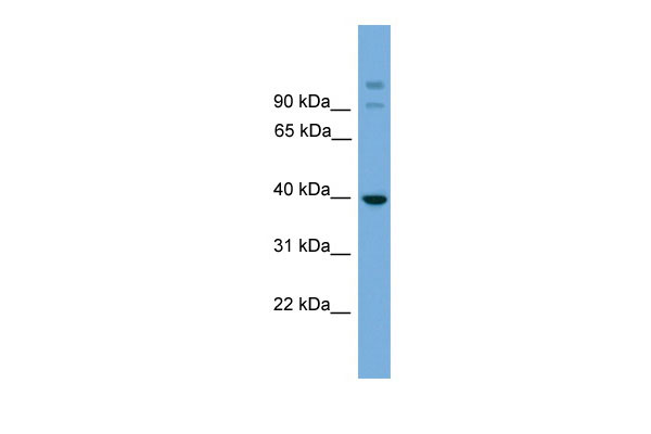1 - SUGT1 antibody - middle region AI13390