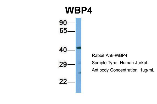 1 - WBP4 antibody - N-terminal region AI13397