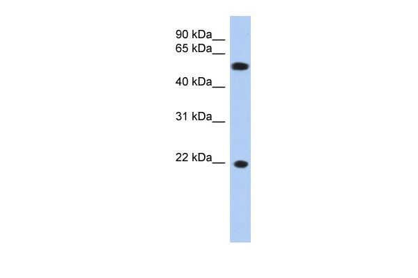 1 - CRYGC antibody - middle region AI13408