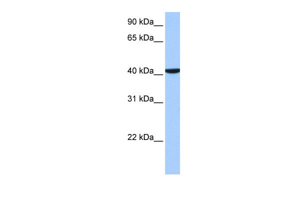 1 - CC2D1B antibody - C-terminal region AI13414