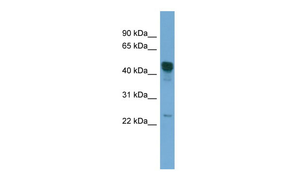 1 - DYX1C1 antibody - middle region AI13429