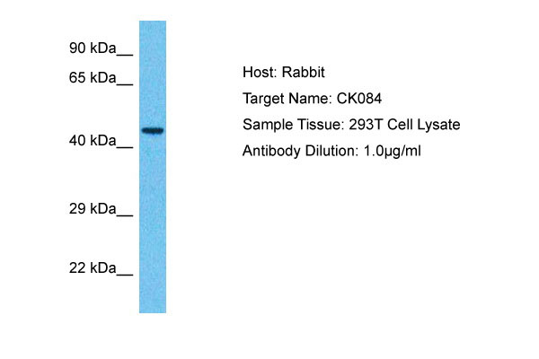 1 - CK084 Antibody - N-terminal region AI13440