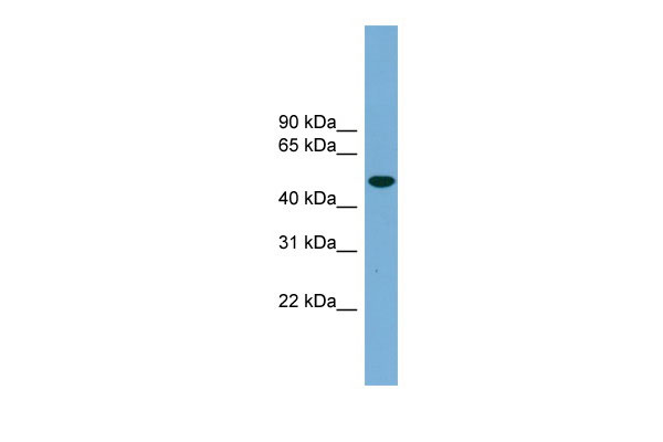 1 - UBQLNL antibody - middle region AI13457