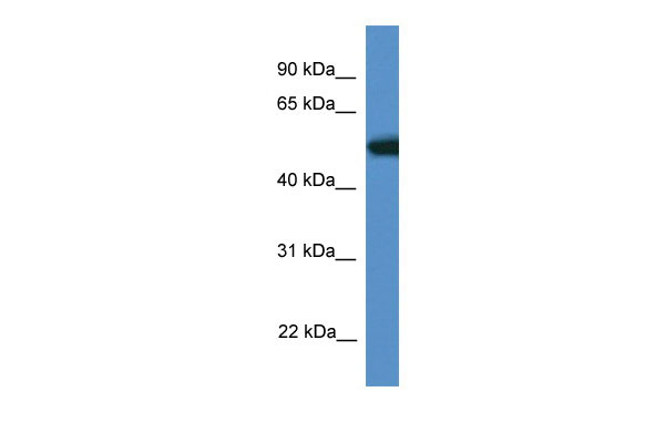 1 - Tigd4 antibody - N-terminal region AI13469