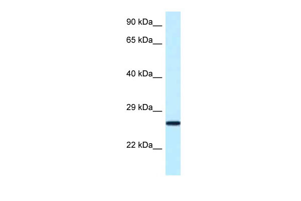 1 - Nudt16 antibody - N-terminal region AI13485