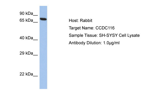 1 - CCDC116 Antibody - C-terminal region AI13503