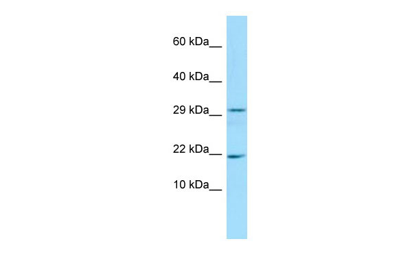 1 - RGD1565997 antibody - N-terminal region AI13526
