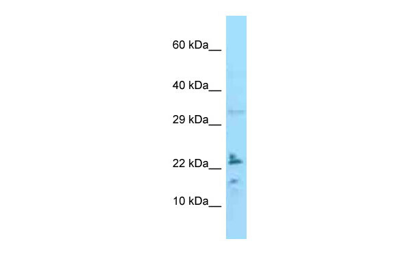 1 - IL24 Antibody - C-terminal region AI13545