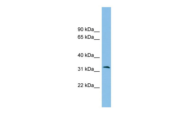1 - ZPBP2 antibody - middle region AI13564