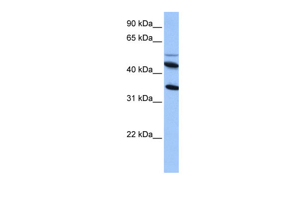 1 - IL13RA2 antibody - middle region AI13577