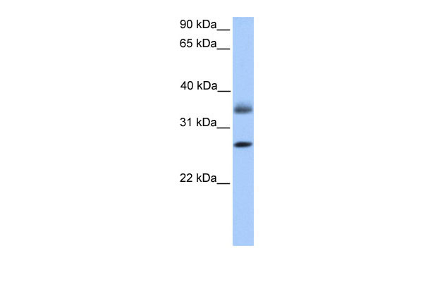 1 - LGALS8 antibody - C-terminal region AI13594