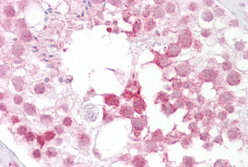 2 - Ift88 antibody - N-terminal region AI13595