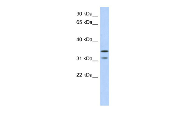 1 - C17orf81 antibody - middle region AI13600