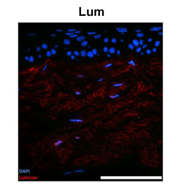 2 - Lum antibody - N-terminal region AI13670