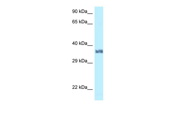 1 - Lum antibody - N-terminal region AI13670