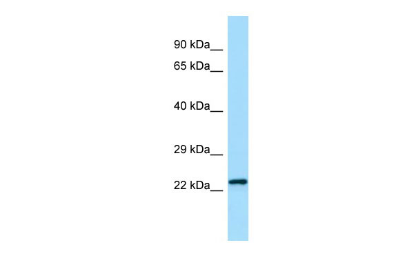 1 - Chmp2b Antibody - N-terminal region AI13722