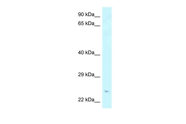1 - Stxbp6 antibody - N-terminal region AI13724