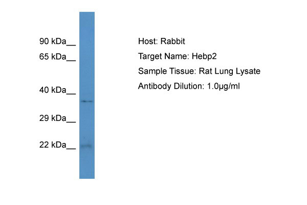 1 - Hebp2 Antibody - N-terminal region AI13727