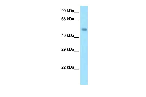 1 - Snx5 antibody - N-terminal region AI13731