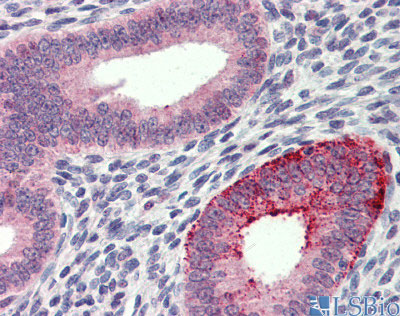 2 - FCHO1 antibody - middle region AI13755