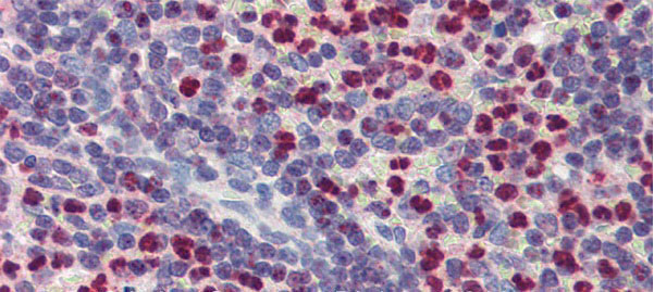 2 - FCHO1 antibody - middle region AI13755