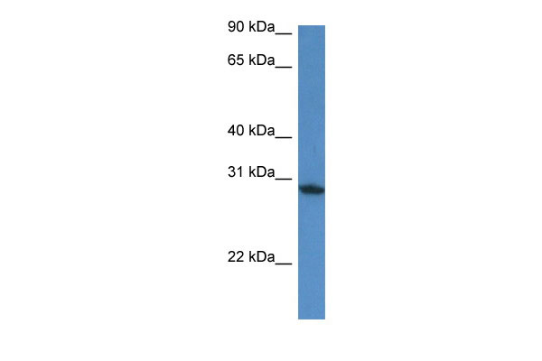 1 - Fam168a antibody - N-terminal region AI13756