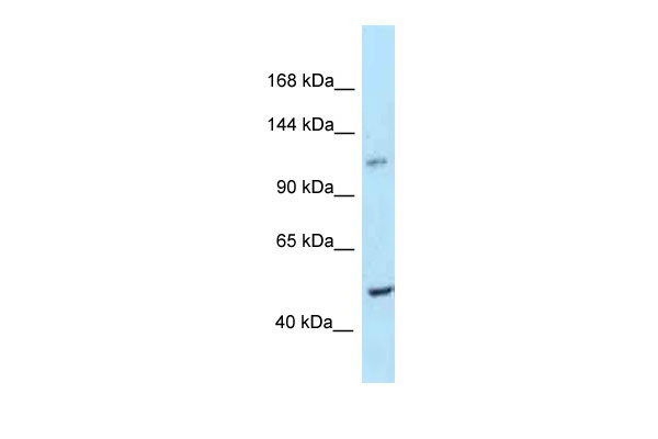 1 - Ppip5k2 antibody - C-terminal region AI13760
