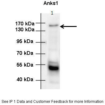 5 - Anks1 antibody - C-terminal region AI13762