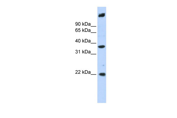 1 - SSBP3 antibody - middle region AI13786