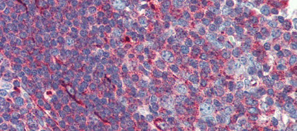 2 - PHACTR1 antibody - middle region AI13789