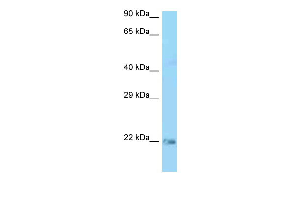 1 - Kras antibody - N-terminal region AI13790