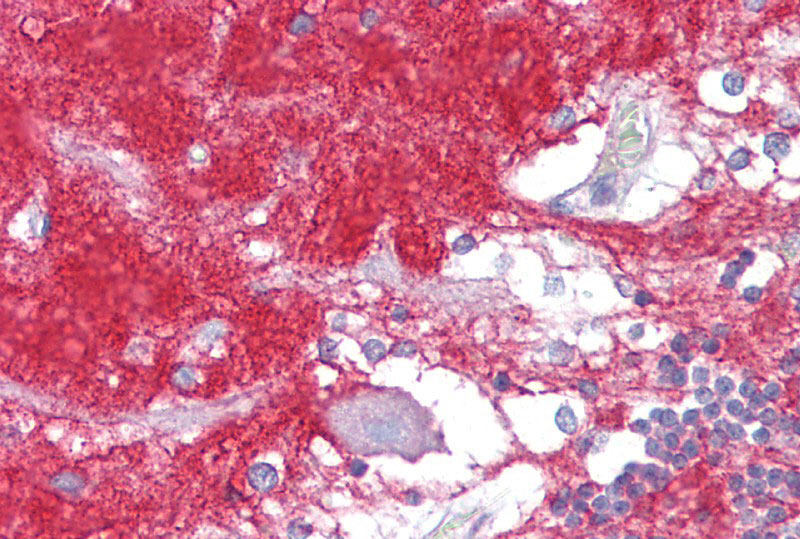2 - GNAO1 antibody - middle region AI13794