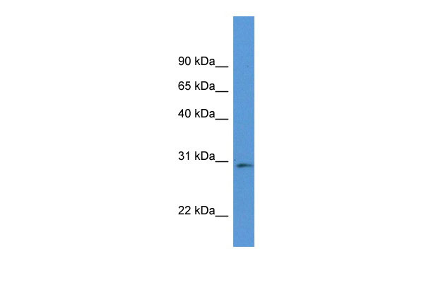 1 - Rpia antibody - middle region AI13797