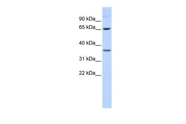 1 - EPN2 antibody - middle region AI13802