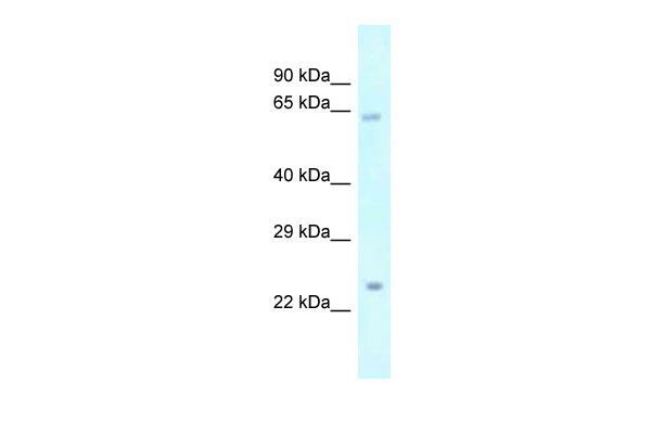 1 - Gm216 antibody - middle region AI13808
