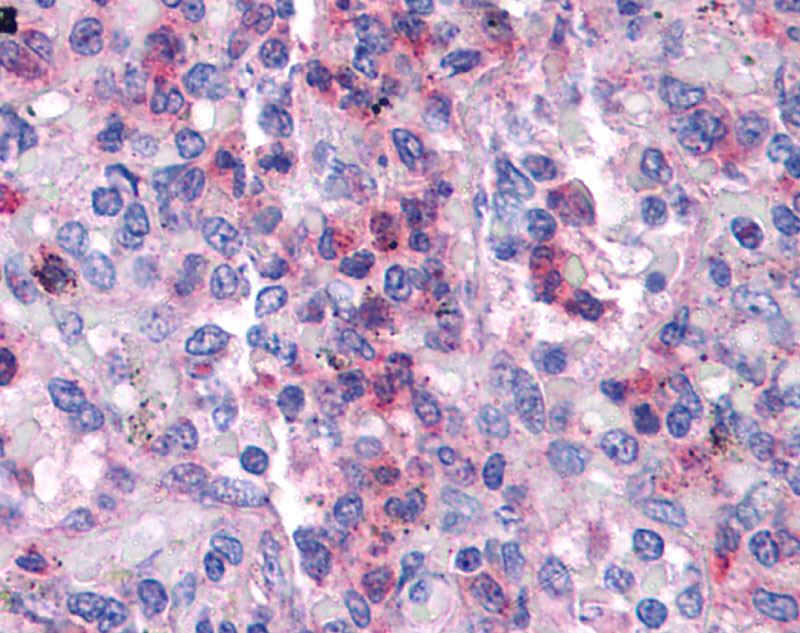 2 - SGK3 antibody - N-terminal region AI13822