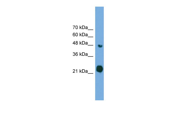 1 - RAB37 antibody - middle region AI13845