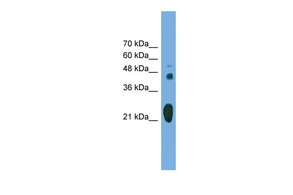 1 - RAB37 antibody - middle region AI13846