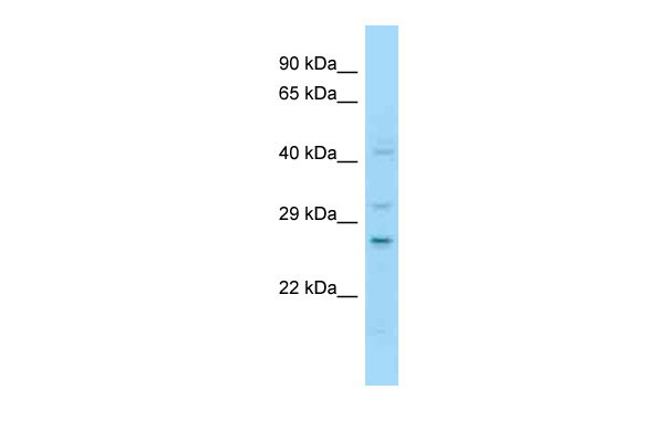 1 - NOTCH2NL antibody - C-terminal region AI13885