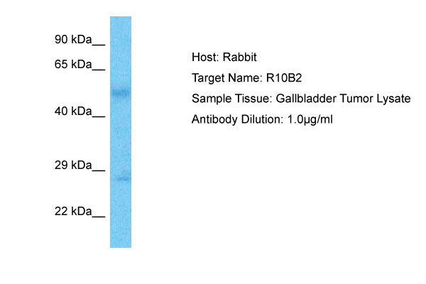 1 - R10B2 Antibody - N-terminal region AI13892