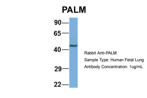 1 - PALM antibody - N-terminal region AI13923