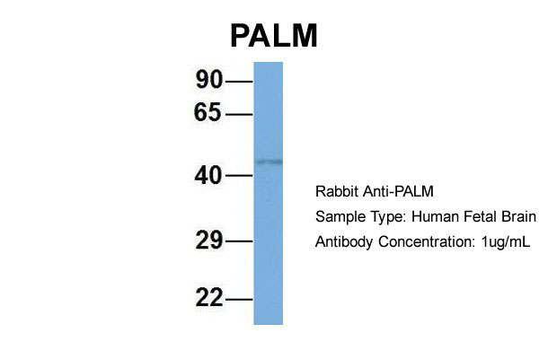 1 - PALM antibody - N-terminal region AI13923